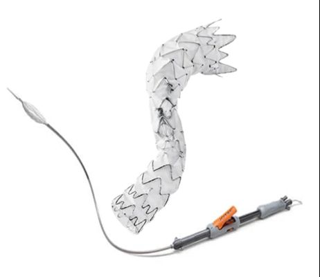C. R. Bard Fluency Plus Vascular Stent for Dissection Restenosis after PTA in Peripheral Arteries​​