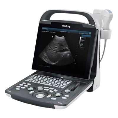 Mindray DP-10 Portable Ultrasound System Under 5.5kg with 12.1" LED for Point-of-Care Imaging