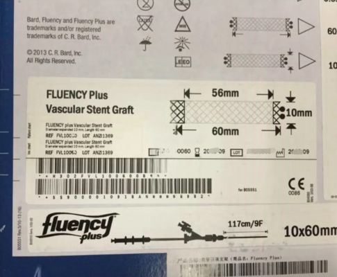 C. R. Bard Fluency Plus Vascular Stent for Dissection Restenosis after PTA in Peripheral Arteries​​