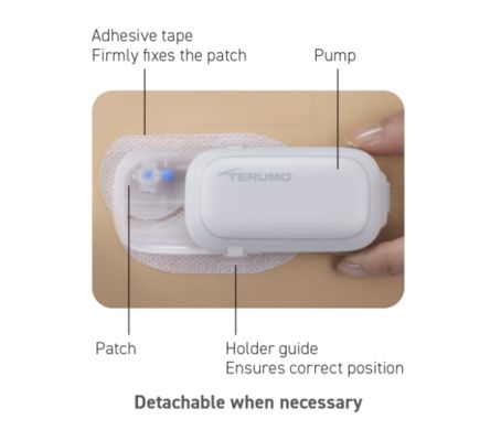 Terumo Medisafe WITH Insulin Patch Pump Detachable with Remote Control for Daily Freedom​​
