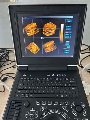 E20 Veterinary Color Doppler Ultrasound Portable System with Multi-Species Presets 7 Probes Selectable